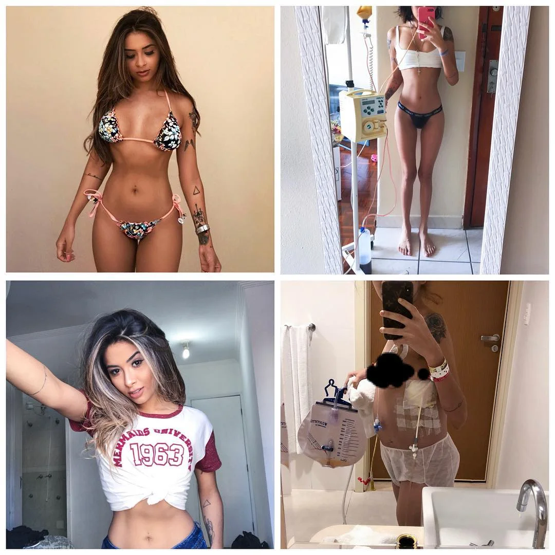 Com o tempo a gente aprende que tudo isso que achamos  Importante como status, roupas, festas, dinheiro... é passageiro e passamos a enxergar o quanto nossa saúde é valiosa, nossa família, amigos, momentos... só quem tem, só quem já lutou, só quem já perdeu, ou tem parentes com o câncer sabe o sofrimento e a luta de cada dia pra nós, cada batalha vencida é uma grande lição. A gente quando é jovem pensa que nunca vai acontecer nada de ruim, vivemos como se não houvesse o amanhã, mas de uma hora pra outra isso tudo pode mudar! Valorizem a família, os amigos, e principalmente sua saúde. Aproveitem e sejam gratos pelo agora! Mesmo passando por momentos de dores e angústias, eu continuo sendo grata pela minha vida, continuo  crendo que tudo vai ficar bem no final, continuo acreditando que vou realizar todos os meus sonhos. Amém!! 🙏